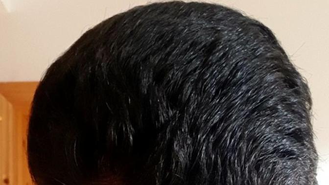 Am I going BALD in your opinion?