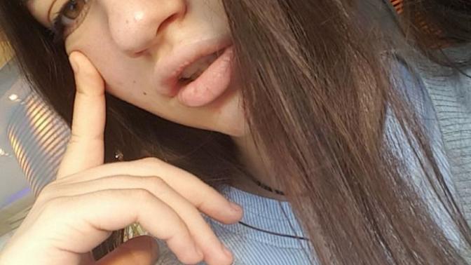 Is my nose ugly?