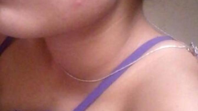 Teen problem please help:How do I get rid of these things on my face?