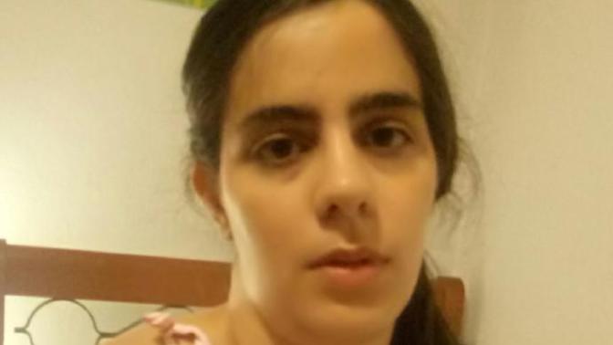 Do I look like an old hag? Do I need botox or lifting?