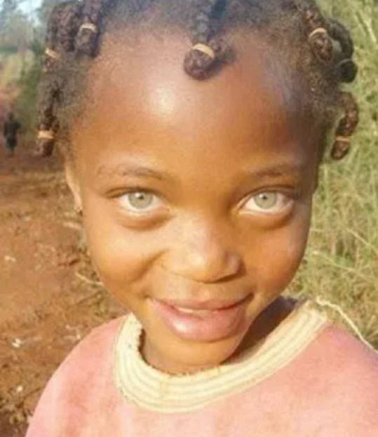 What color eyes look the most exotic on black people??