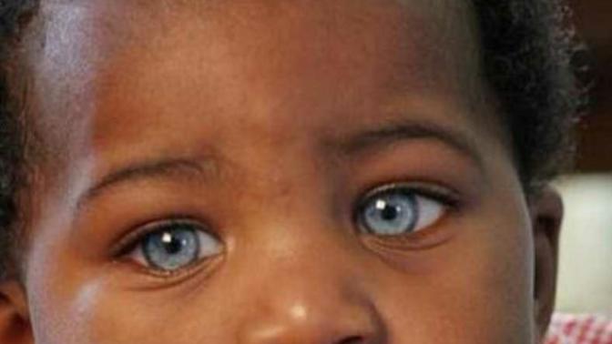What color eyes look the most exotic on black people?