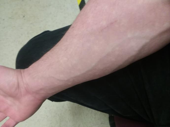 Are veins hot/attractive?