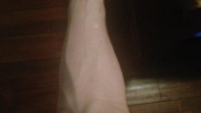 Are veins hot/attractive?