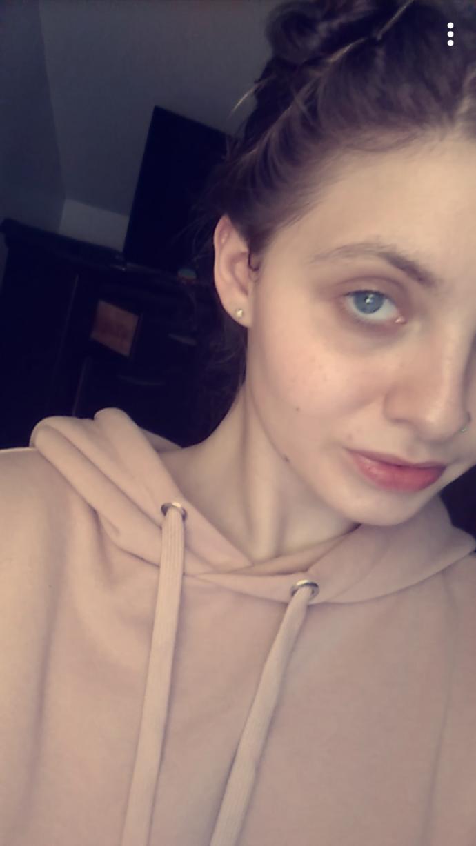 (pic) Dark circles under eyes? How do I get rid of them?