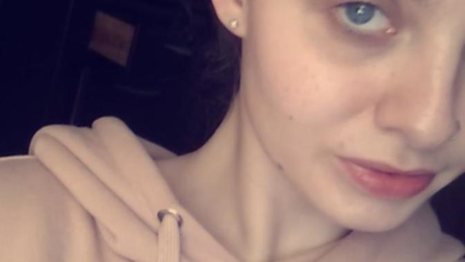 (pic) Dark circles under eyes? How do I get rid of them?