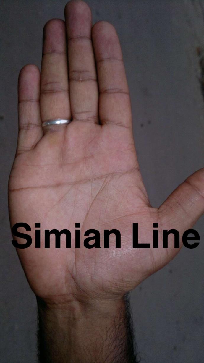 Thoughts on simian crease on palm?