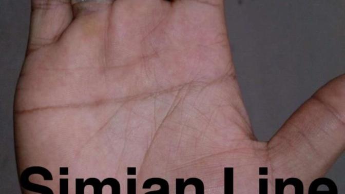Thoughts on simian crease on palm?