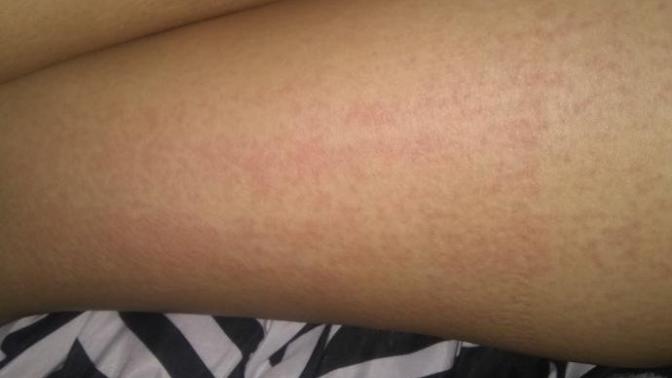 Girls, Wtf is on my legs?