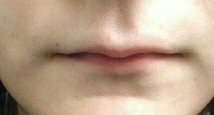 Girls, do you have thin lips? Are you self conscious about them??