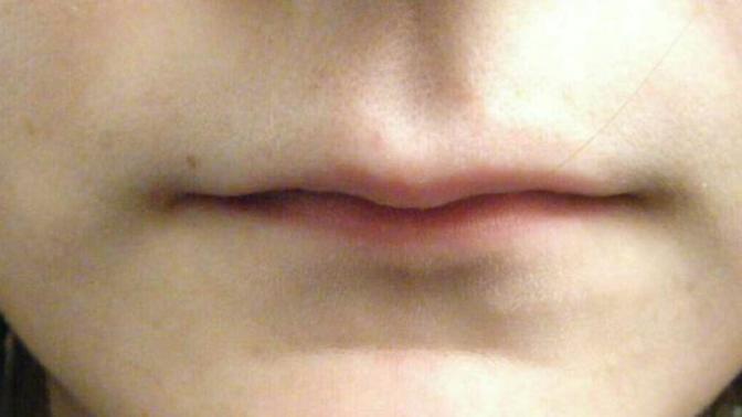 Girls, do you have thin lips? Are you self conscious about them?