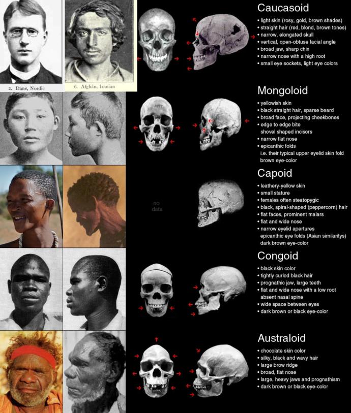 Why do people (Americans mostly) think being Caucasian is to do with skin tone/colour?