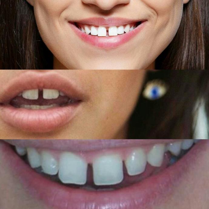 What to you think of girls with gaps in her teeth??