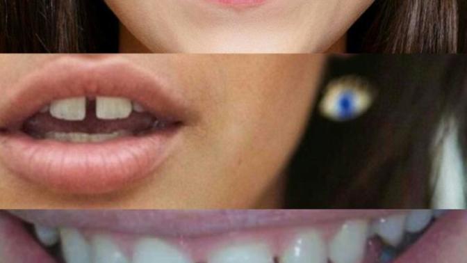 What to you think of girls with gaps in her teeth?