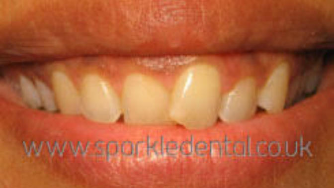 Insecure about my teeth?
