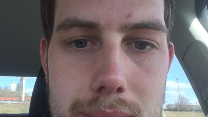 Girls, Which picture do I look best in which do I look worse in? Do I look better with a lot of hair or shaved? And yeah I know about the acne?