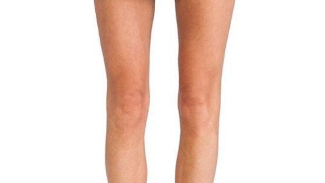 Guys, Is a woman having chicken legs a deal breaker for you?