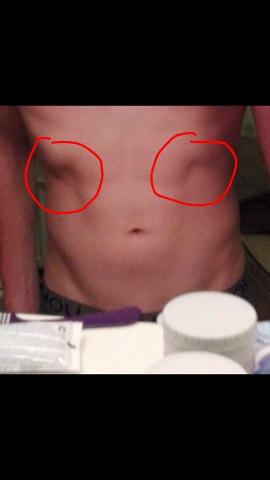 Am i lacking upper obliques??