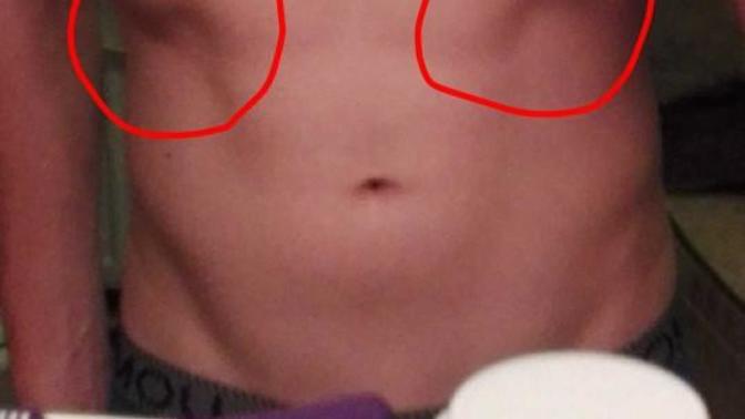 Am I lacking upper obliques?