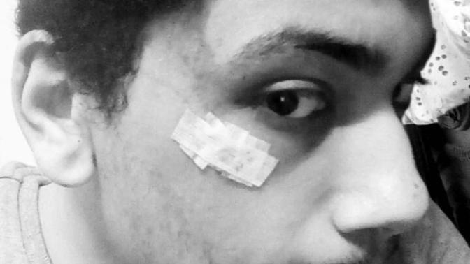 Do stitches leave a scar?