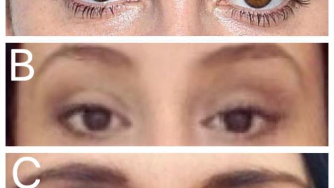Rate these eyes 1 -10 ?