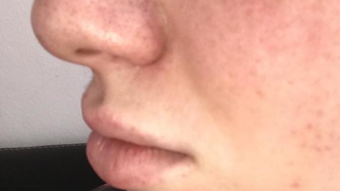 I am always told that my nose is big and ugly, and that my smile is uglier because of the gap in my front teeth?
