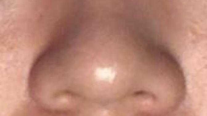 What type of nose is this?