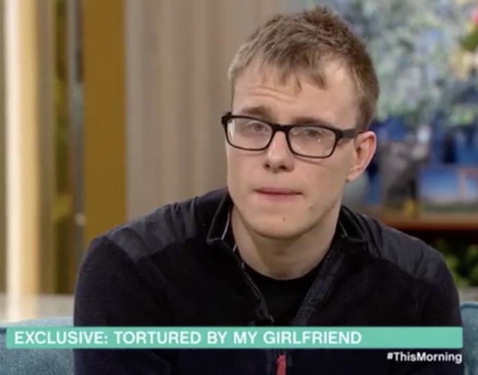 Male Domestic abuse survivor reveals horrific scars inflicted by his Girlfriend. What are your thoughts about this?