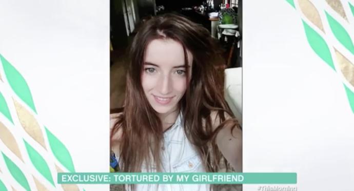 Male Domestic abuse survivor reveals horrific scars inflicted by his Girlfriend. What are your thoughts about this?