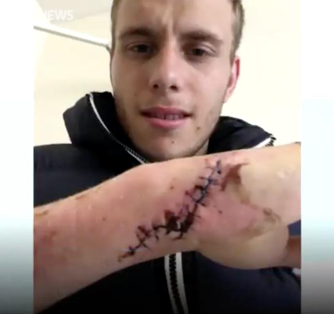 Male Domestic abuse survivor reveals horrific scars inflicted by his Girlfriend. What are your thoughts about this?