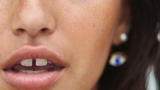 What do you think of the gap tooth?