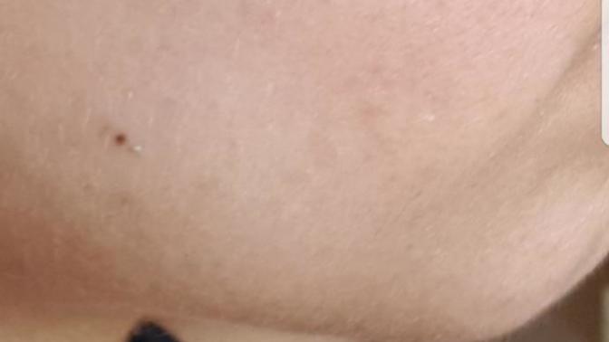 Why are my cheeks always red like that?