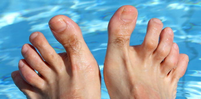 Do you think all feet are ugly?