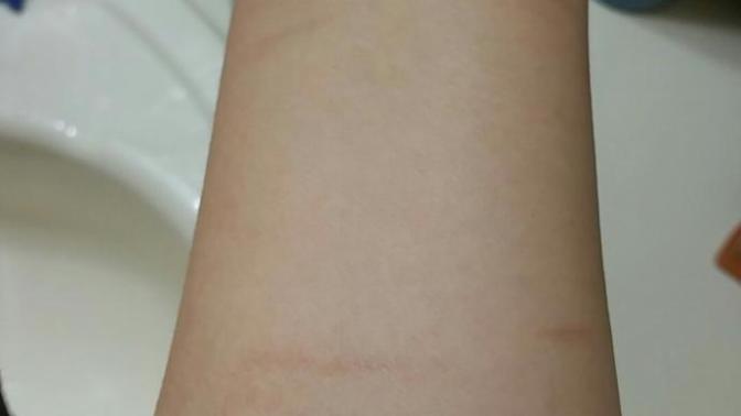Does it look like self harm scars?