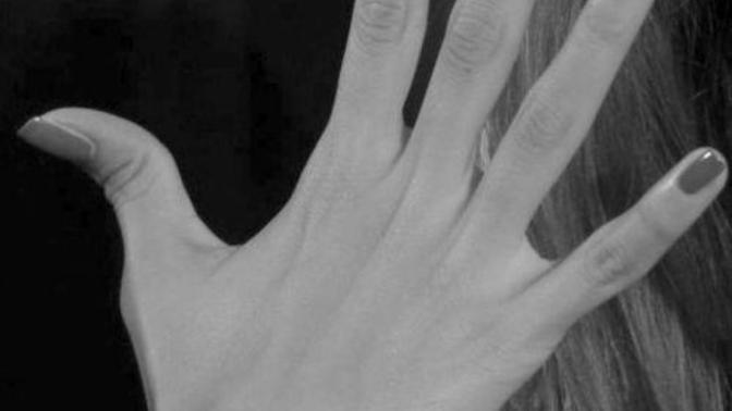 Tiny Wrists and Bony Hands?