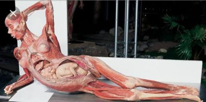 Would you go to this exhibition of bodies if you had the chance?