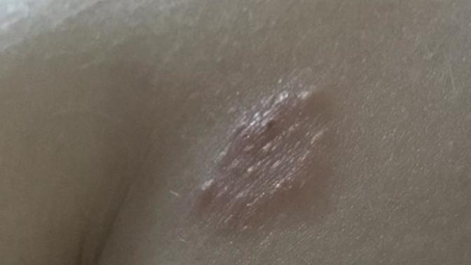 Weird itchy patch on skin?