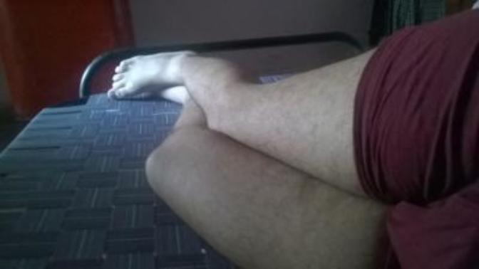 Is it normal color difference?