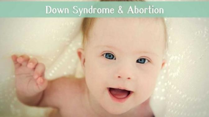 Down Syndrome Abortion?