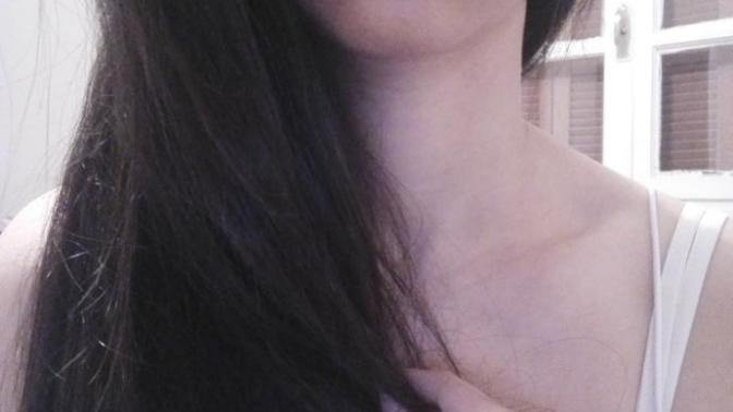 Friends and everyone keeps on telling me I look like I got surgery on my lips, do they really look that big?