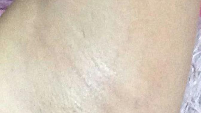 Girls, does my armpit look OK?