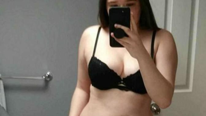 Stretch Marks a Turn Off?