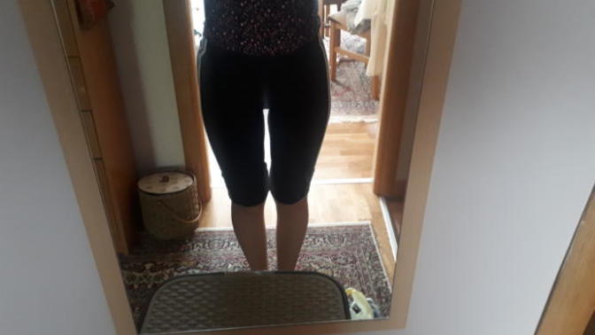 Are these bow legs?