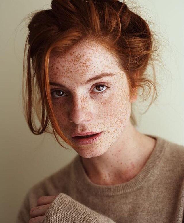 Have you ever seen a person that has freckles all over the face in real-life?