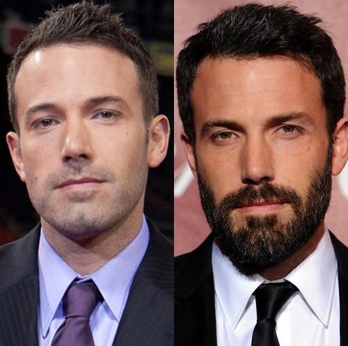 Do guys really look a whole lot better with beards?