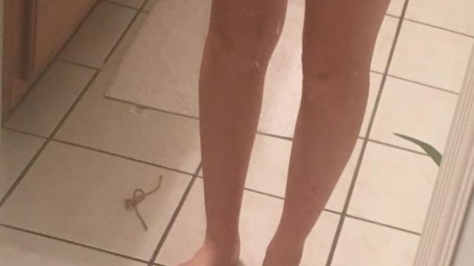 Are these legs fat or ugly? Or are they both?