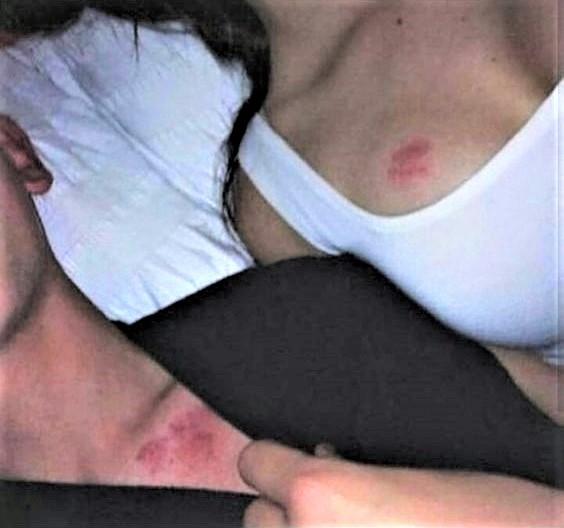 Do you like giving/getting a hickey?