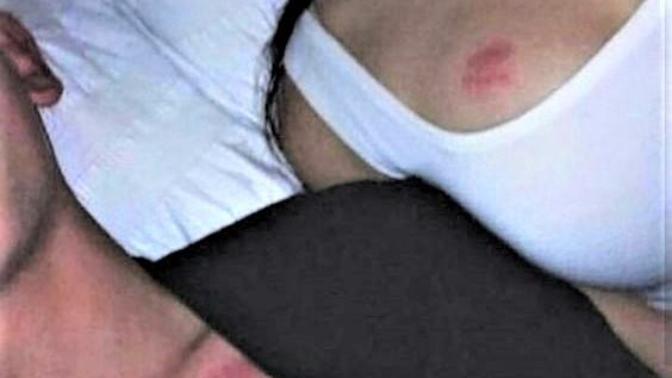 Do you like giving/getting a hickey?