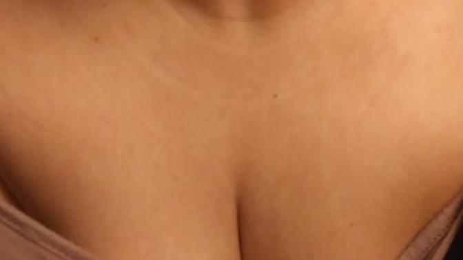 Are light stretch marks or blemishes near the chest a turn off?