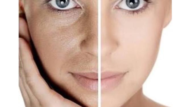 How do I get a clear skin like that?
